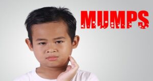 Kasus Mumps di Kecamatan Sangatta Utara Meningkat, Kepala Puskesmas Sangatta Utara Edarkan Himbauan Kesehatan ke Sekolah